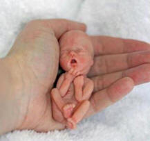 Fetus in hand